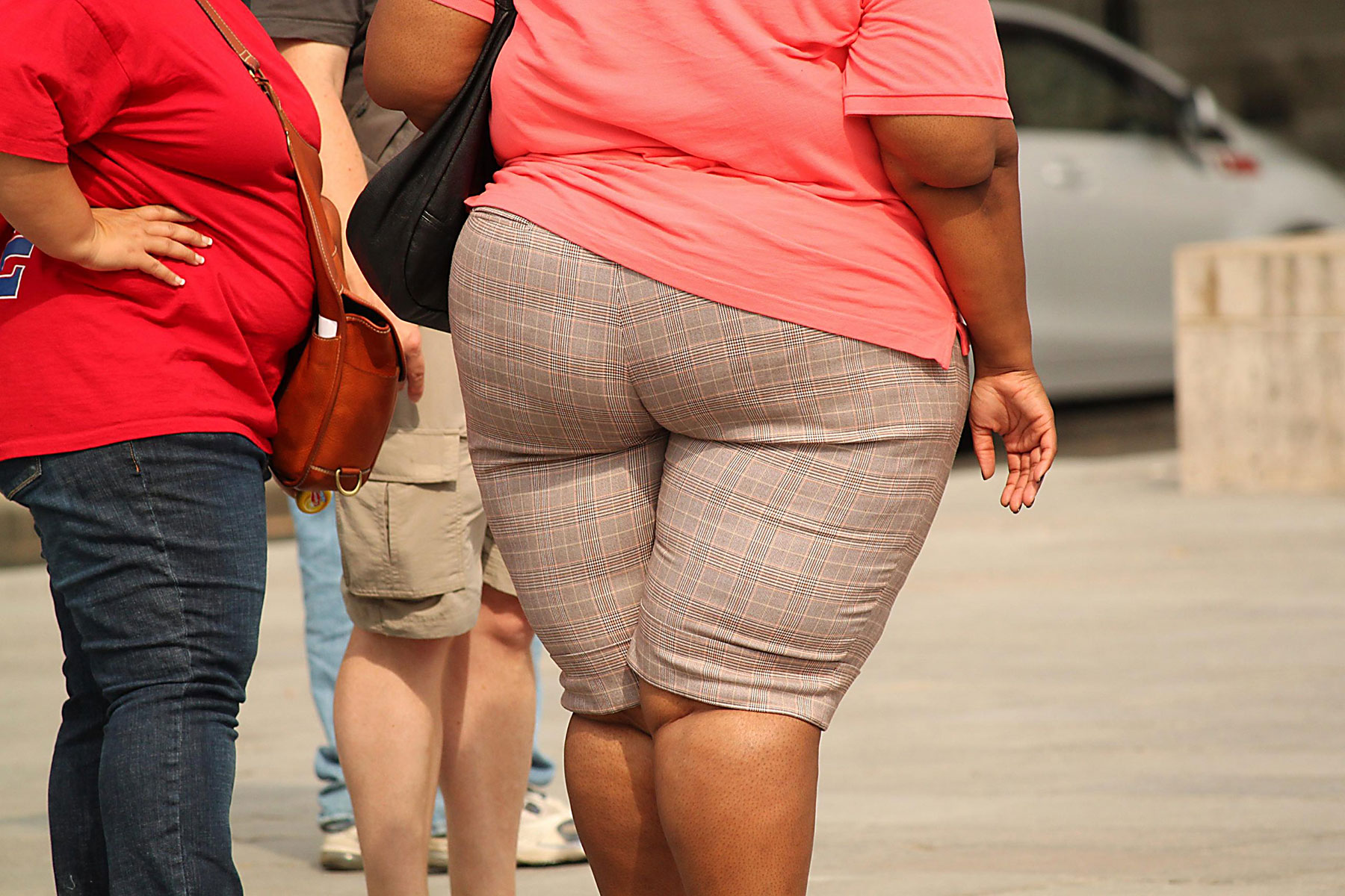 Obese is aproblem in Botswana