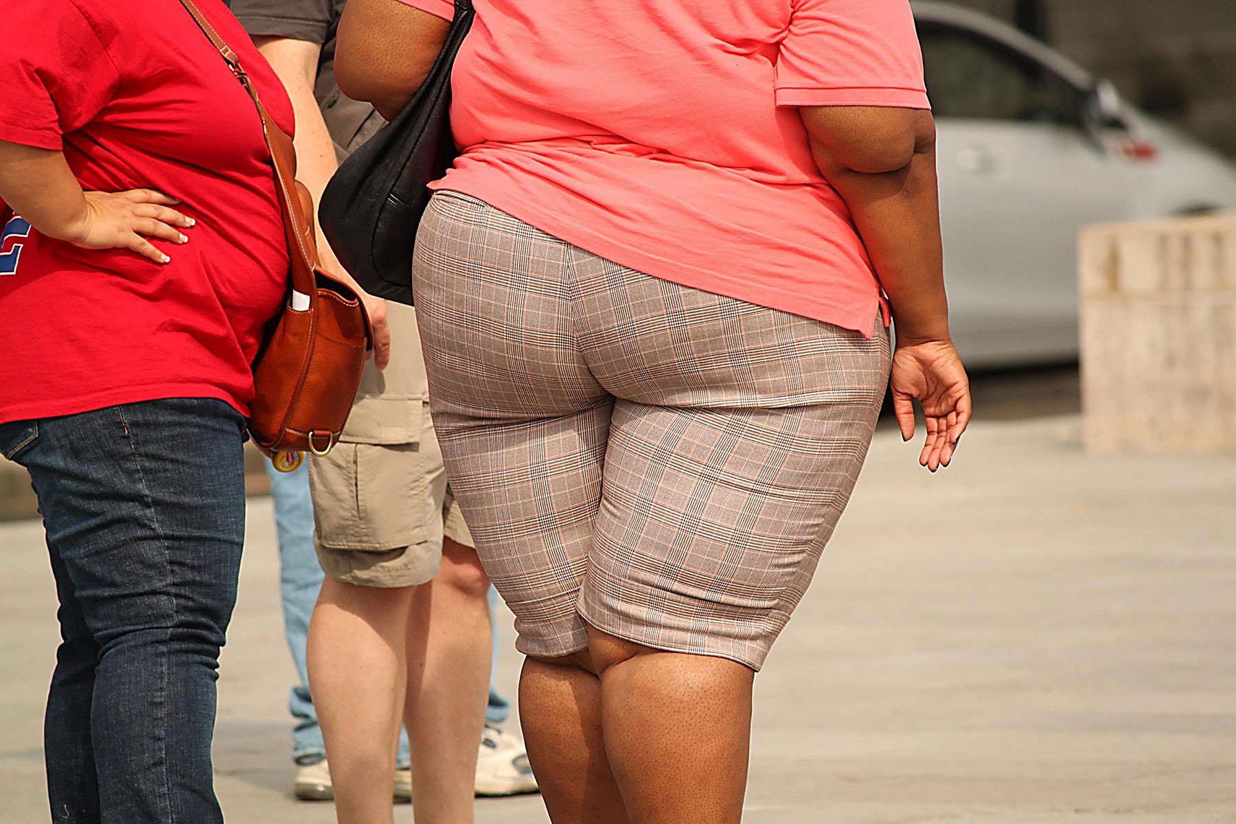 Obesity is a problem in Botswana