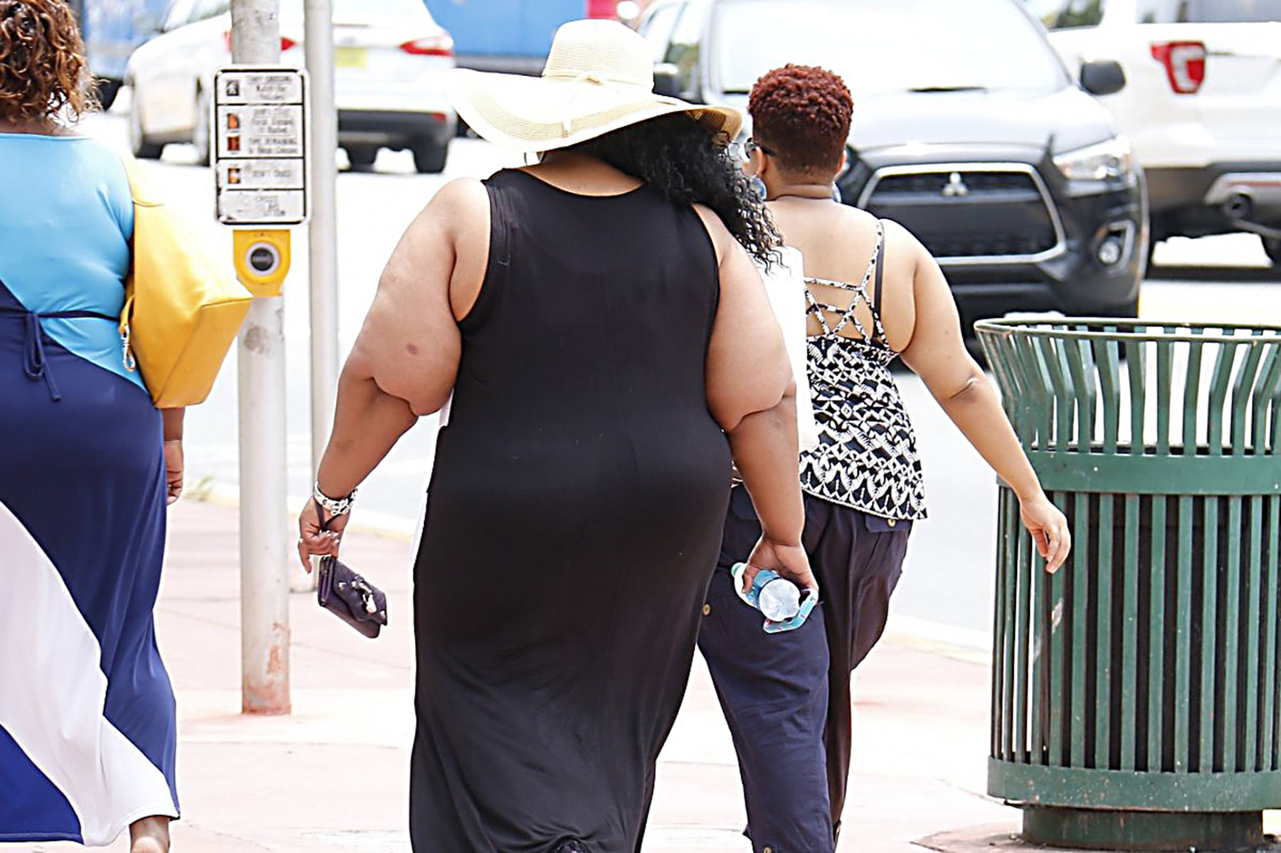 an obese woman
